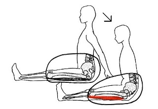 ハムストリングス筋の緊張による骨盤下方牽引の加増