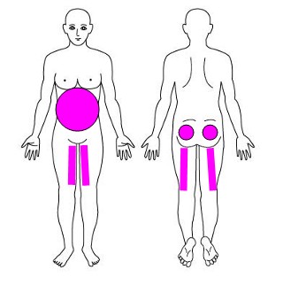 体幹の弱い部位を示した画像