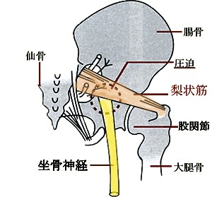 坐骨神経と梨状筋のイラスト