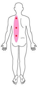 背中の強いコリの図