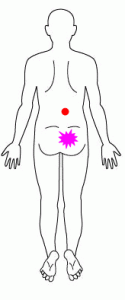 腰のトリガーポイントの図